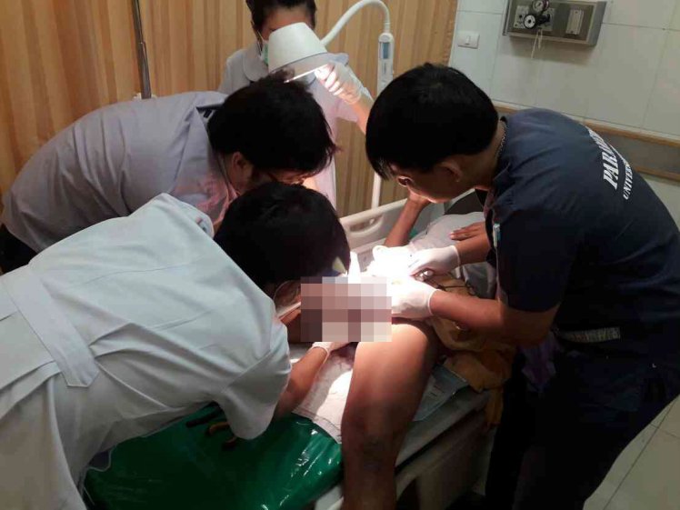 A man getting his penis operated in